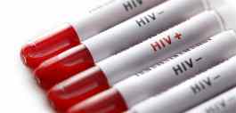 55% das pessoas que contraíram HIV no Reino Unido são heterossexuais