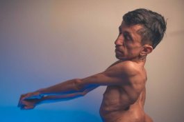 Fotógrafo catarinense retrata a sensualidade de uma pessoa com deficiência